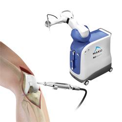 Mako Robotic-Arm Assisted Technology for Total Knee Replacement